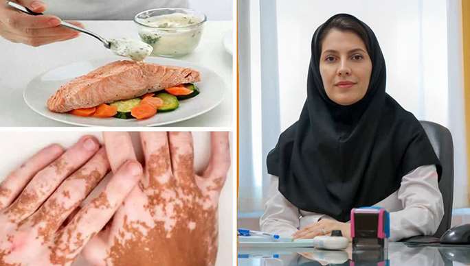 رد یک باور غلط درباره پیسی از سوی متخصص پوست دانشگاه